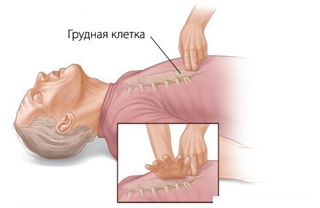 Как выполнить, оказание первой помощи при поражении электрическим током