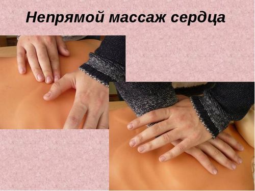 Как выполнить, оказание первой помощи при поражении электрическим током (пострадавший, ток) Как выполнить, оказание первой помощи при поражении электрическим током