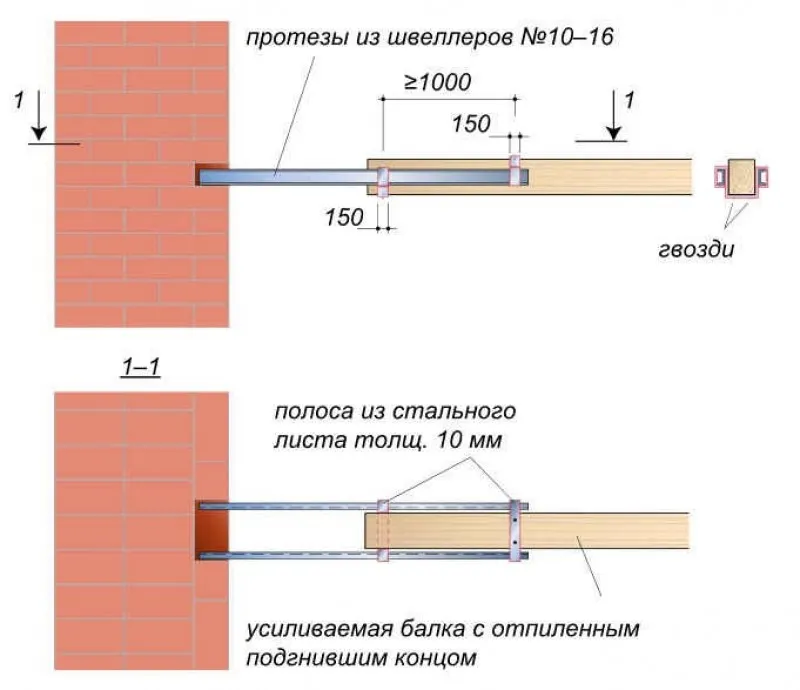 Протезирование с помощью металлических протезов и накладок.